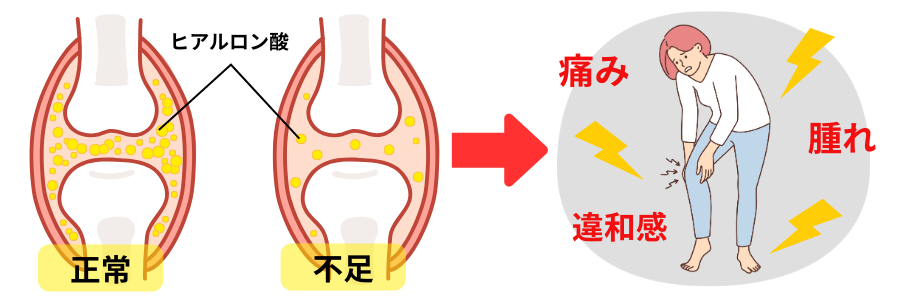 ヒアルロン酸不足