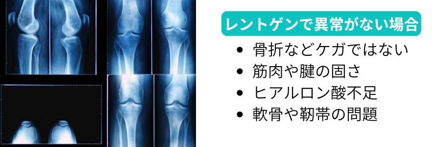 レントゲン