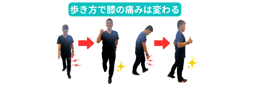歩き方で膝の痛みは変わる